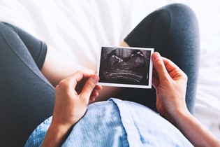 First trimester ultrasounds